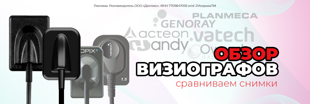 Обзор визиографов