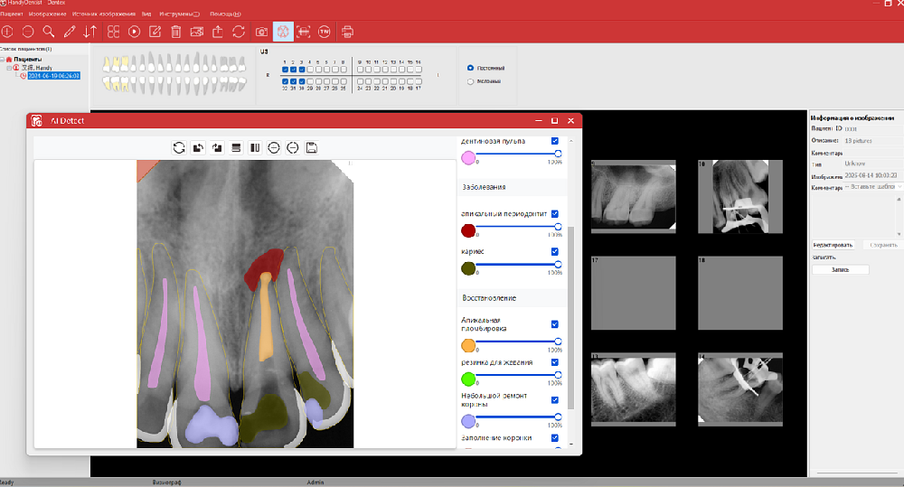 Программное обеспечение HandyDentist — теперь с искусственным интеллектом