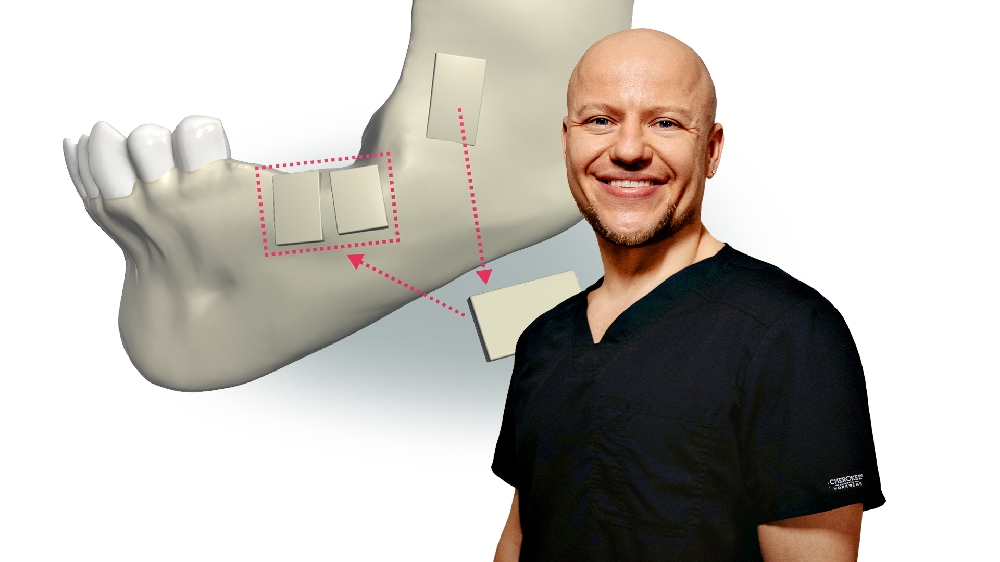 Ламинатная техника по Кюри