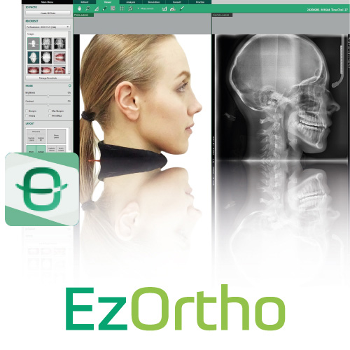 Программа для цефалометрического анализа EzOrtho