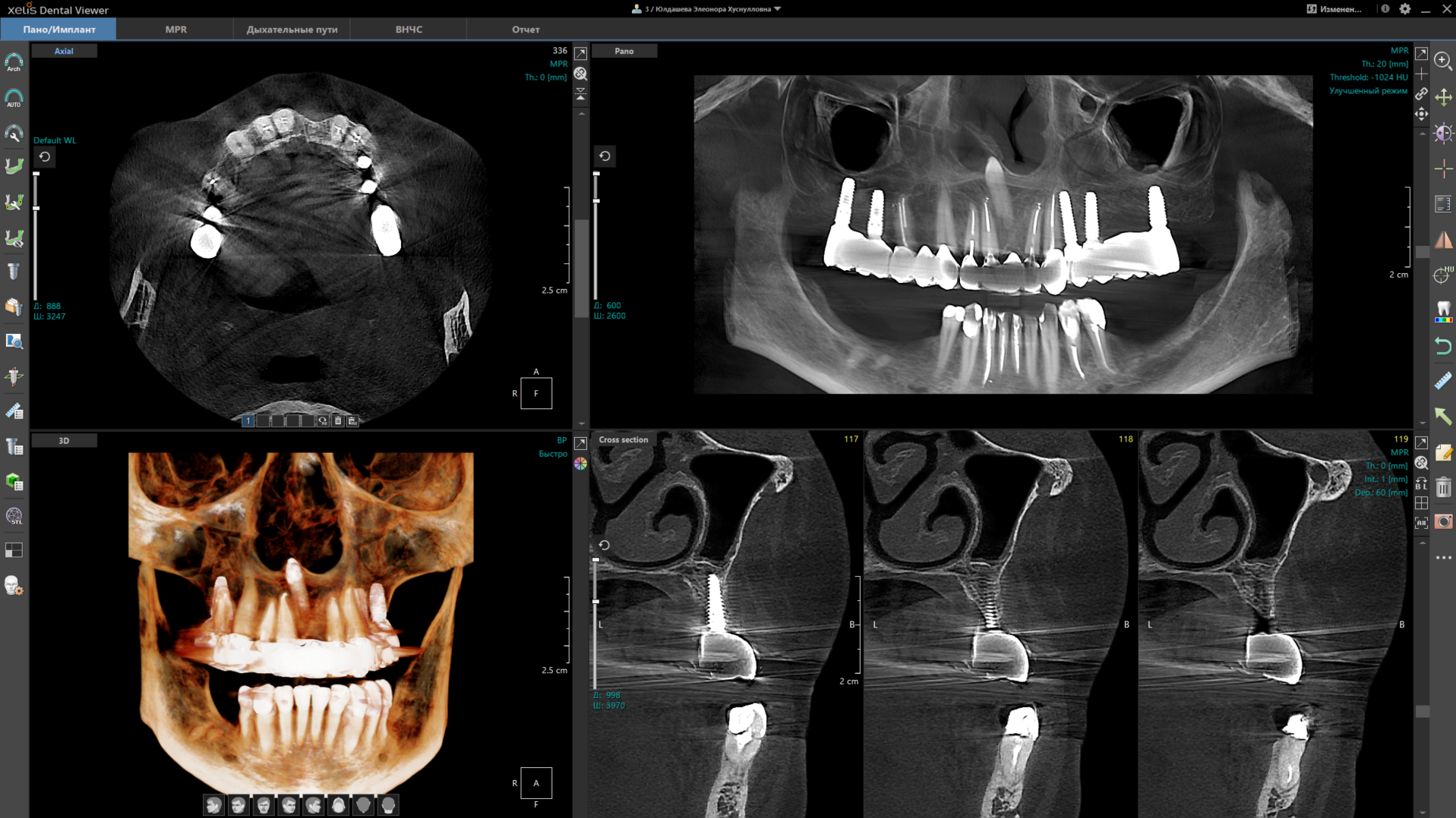 Томограф без цефалостата Point 3D Combi 12x10