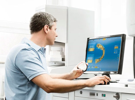 Что такое CAD/CAM в стоматологии?