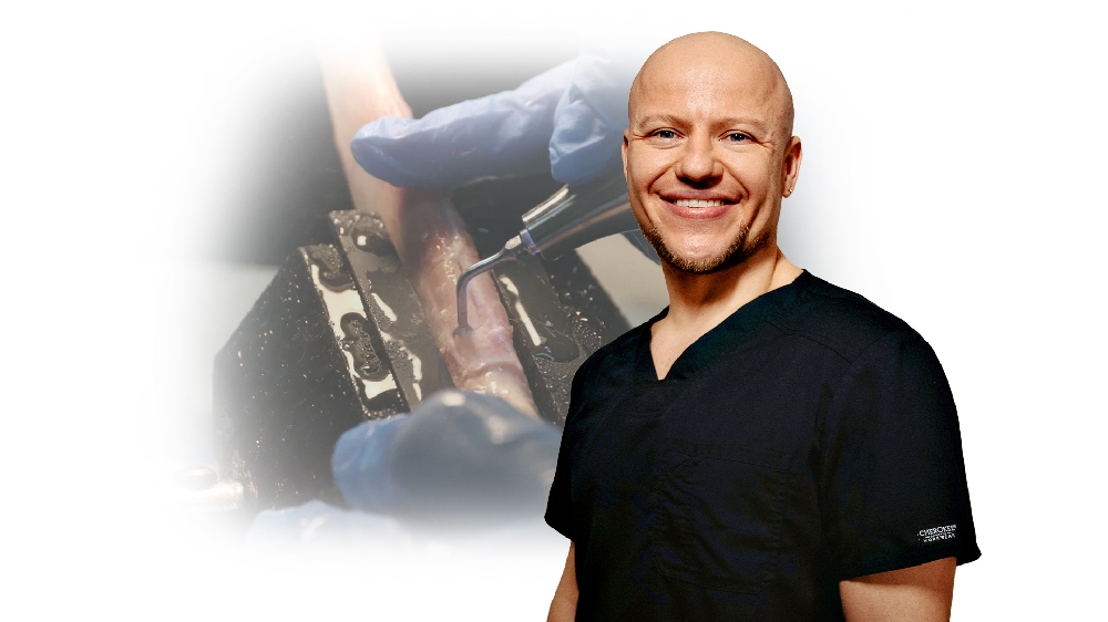 Формирование латерального анатомического окна