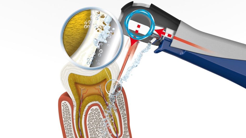 Принцип работы аппаратаVector