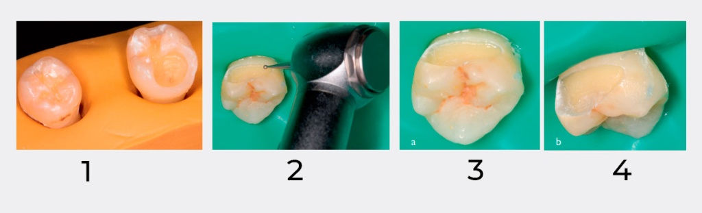 dental-times-nti_13.jpg dental-times-nti_13.jpg