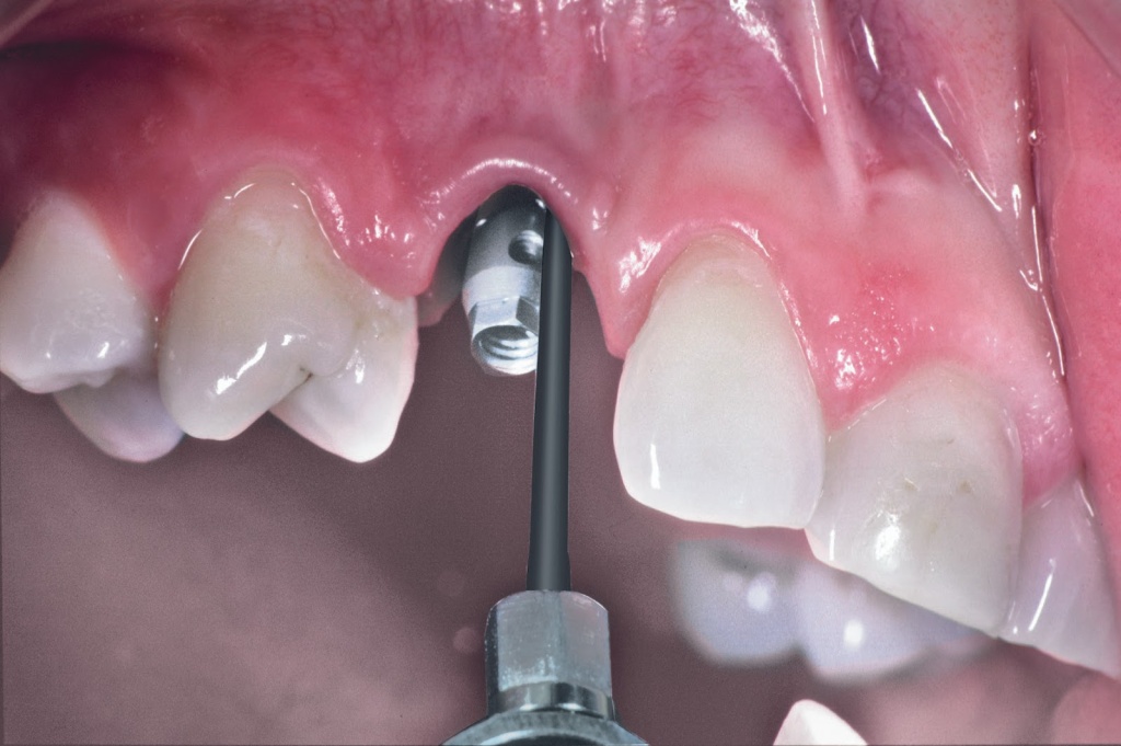 Vector с гибкой насадкой.jpg