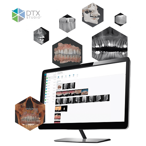 Интегрированное программное обеспечение DTX Studio Clinic