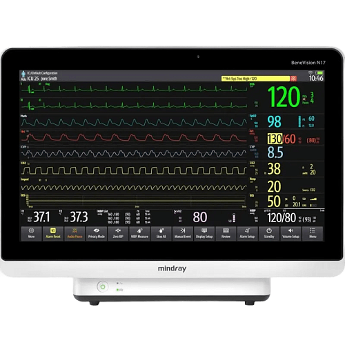 Система мониторинга физиологических показателей BeneVision N17